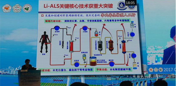 蠕动泵在Li-ALS (非生物型人工肝)系统中的应用